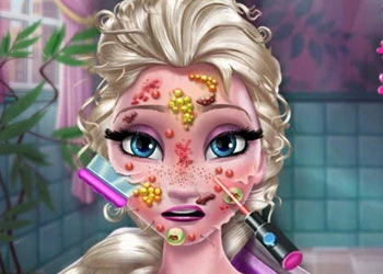 Doctor De La Piel De La Reina Del Hielo captura de pantalla del juego