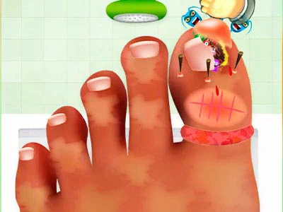 Jeu De Chirurgie Des Ongles capture d'écran du jeu